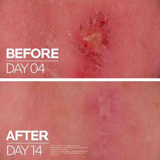 LA ROCHE-POSAY CICAPLAST Ultra-Repairing Soothing Balm B5+